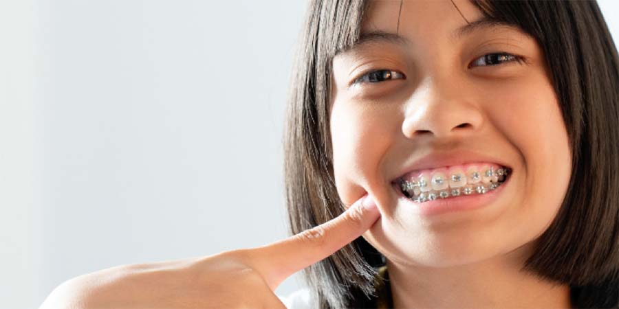 teeth-straightening-dentist-panania